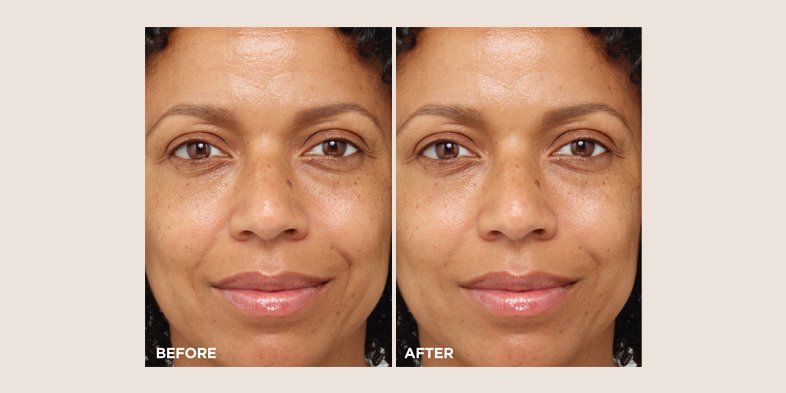 In Article Dry Skin Rules To Follow WaterCream